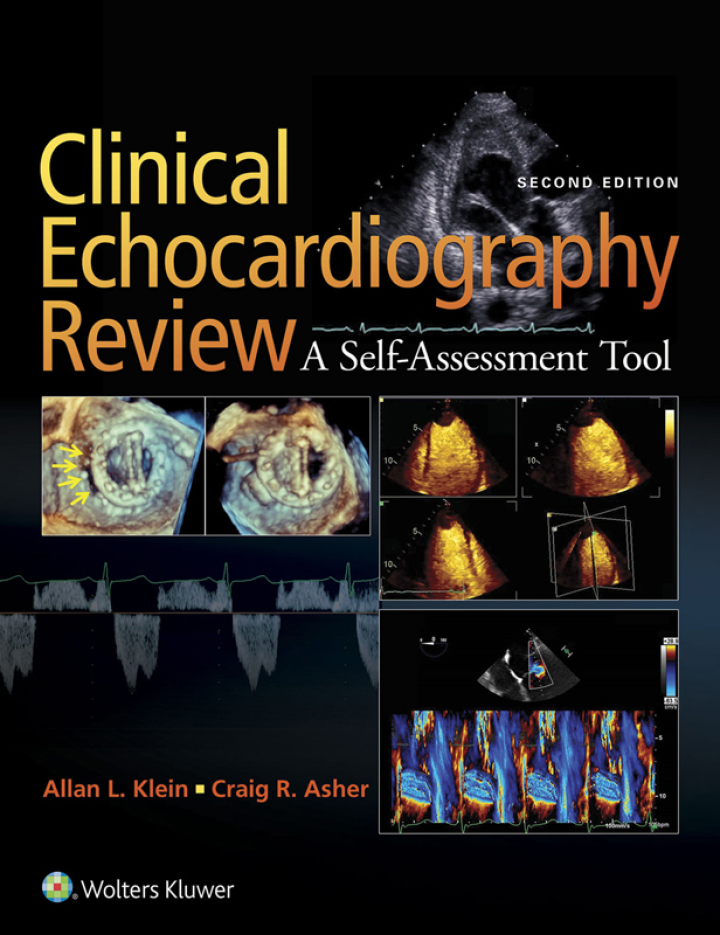 Clinical Echocardiography Review EBook Thelivingtreeco Selling Book Pro